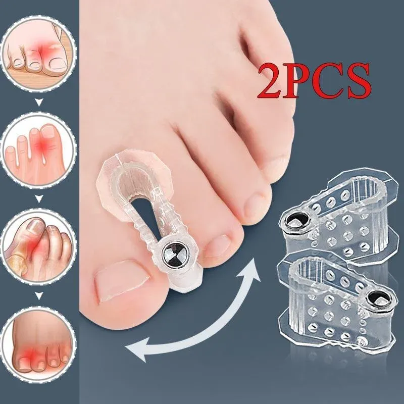 2 stücke Bunion Hallux Valgus Corrector Zehenspreizer Separator Daumen Finger Korrektur Haarglätter Fußpflege Werkzeug