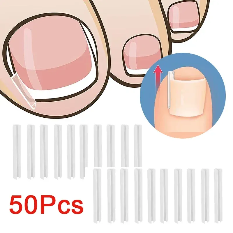 50Pcs Elastische Patch Aufkleber Pediküre Werkzeug Eingewachsene Zehennagel Korrektur Werkzeug Eingewachsene Zehennagel Behandlung Richt Clip Klammer