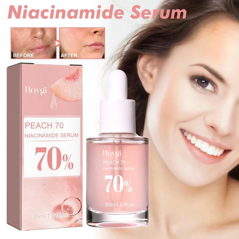 Niacinamid-Serum, 30 ml, aufhellender Porenminimierer, verblasst dunkle Flecken, feuchtigkeitsspendend, gleichmäßiger Hautton, Anti-Aging-Gesichtsserum, nicht reizend