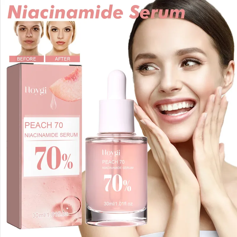 Niacinamid-Gesichtsserum, verblasst Melanin, feuchtigkeitsspendende Verjüngung, verkleinert die Poren, glatte, aufhellende Hautpflege, Serum zur Entfernung dunkler Flecken