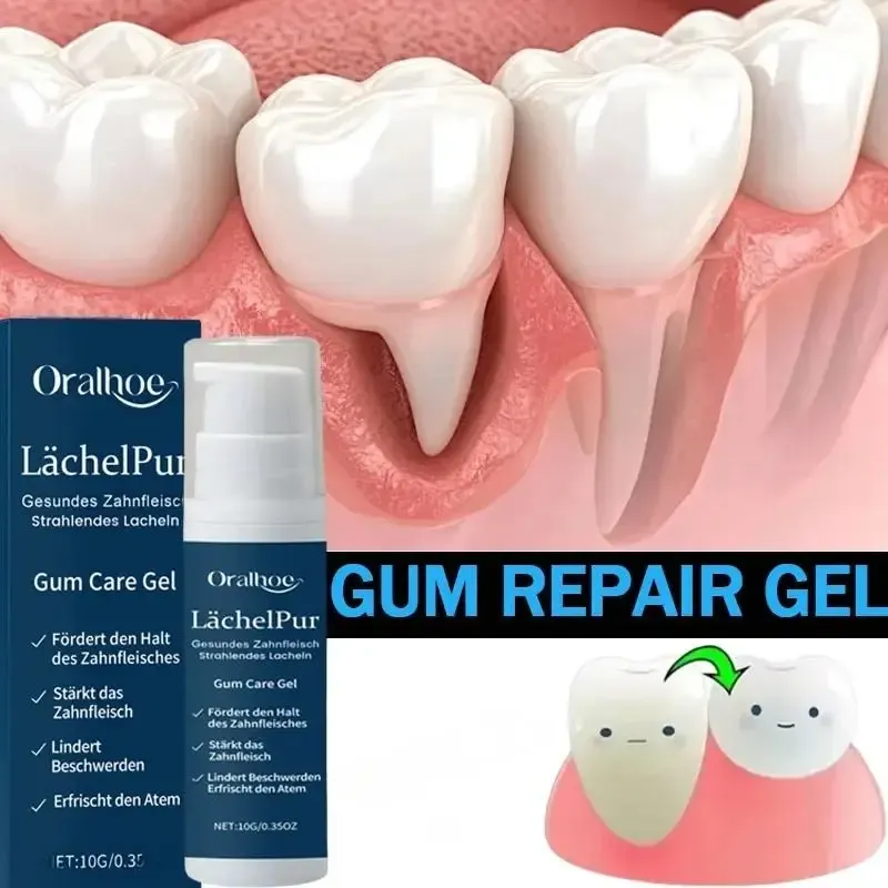 Schnelle Reparatur Zahnfleisch Gel Lindern effektiv Zahnallergie Zahnkaries Zahnreinigung Zahnpasta Lindern Zahnschäden Serum