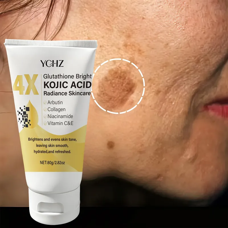 Kojisäure-Gesichtscreme gleicht den Hautton aus, beseitigt dunkle Flecken und fahle Haut – nicht fettig, geeignet für Männer und Frauen – aufhellende und feuchtigkeitsspendende Creme, für Tag und Nacht.