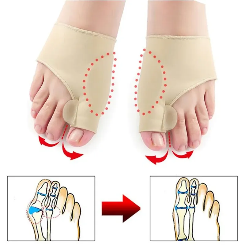 1 paar Toe Separator Hallux Valgus Bunion Corrector Hammer Kappe Haarglätter Fuß Schmerzen Relief Orthopädische Pediküre Werkzeuge Fuß Pflege